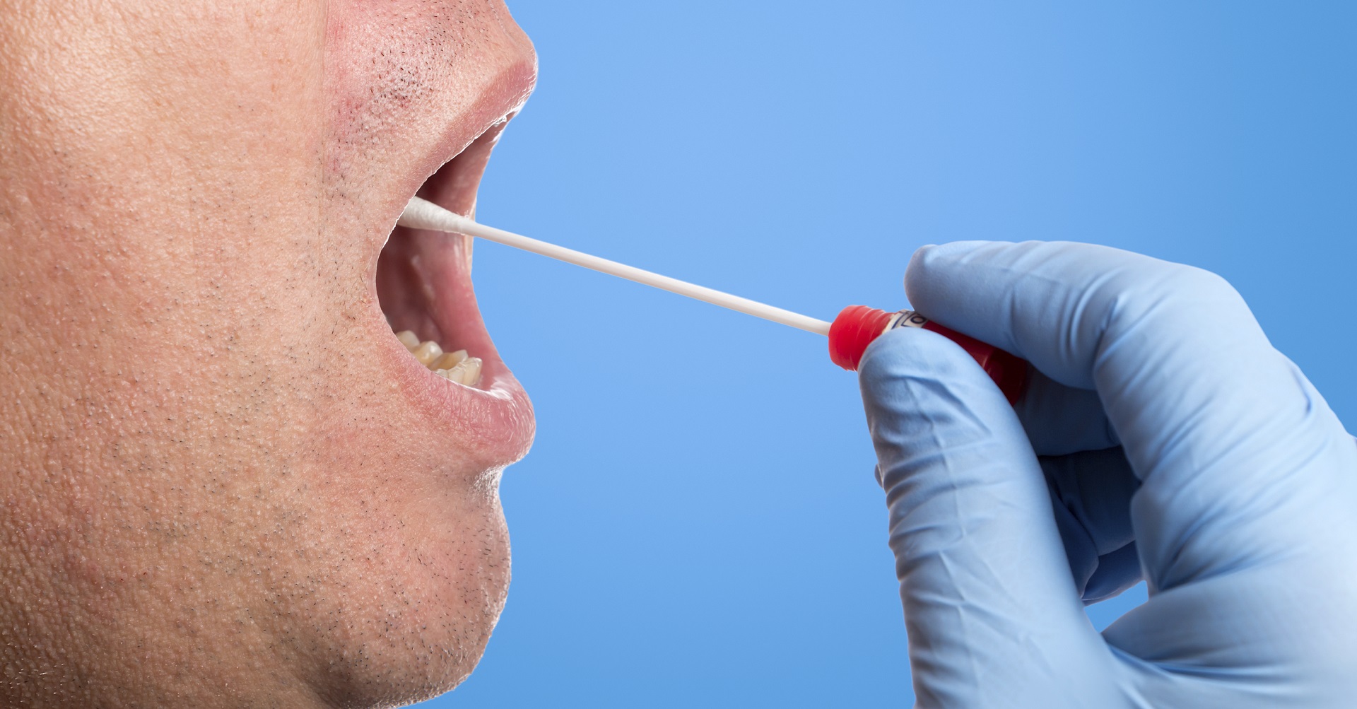 cheek swab with cotton bud